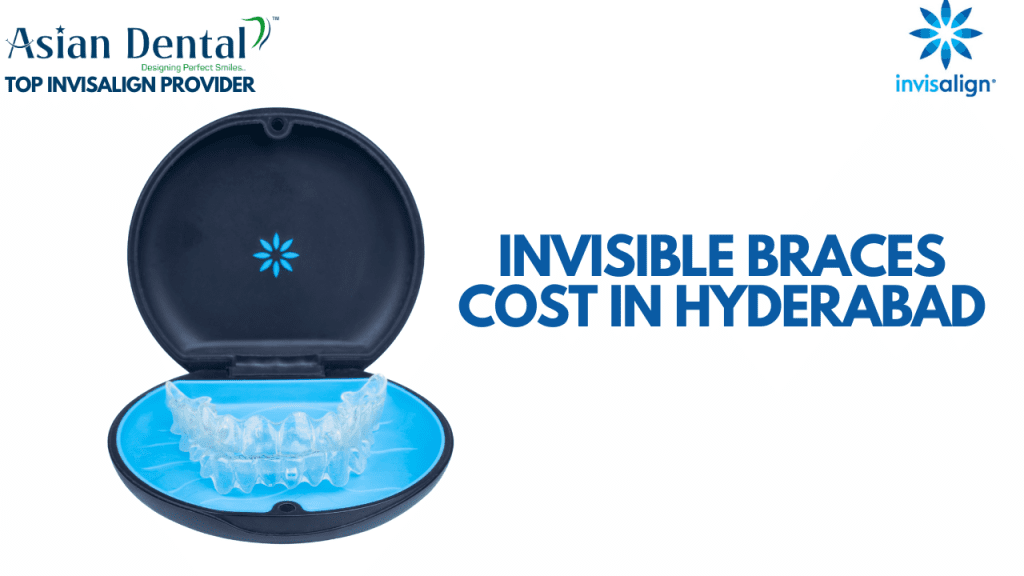Invisible Braces Cost in Hyderabad: A Detailed Breakdown