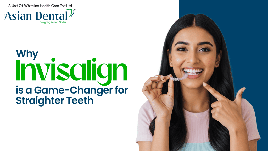 Invisalign in Hyderabad