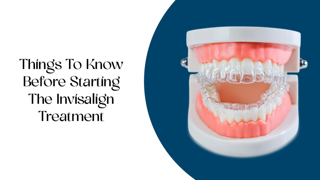 things to know before starting the invisalign treatment