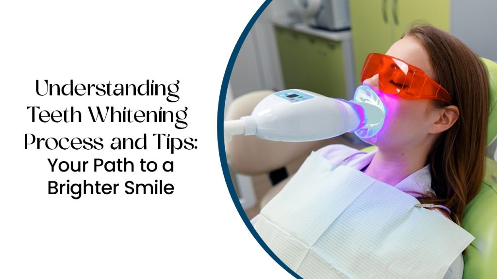 teeth whitening process and tips