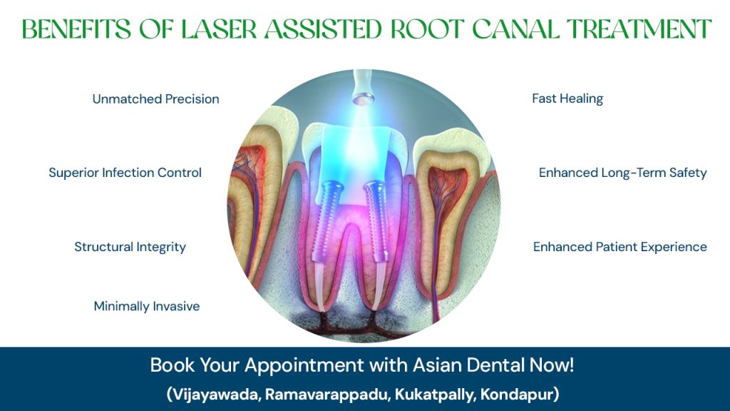 advantages of laser assisted root canal treatment