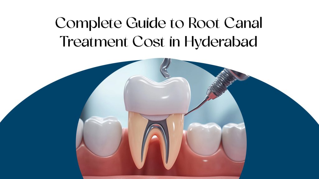asian-dental_complete-guide-to-root-canal