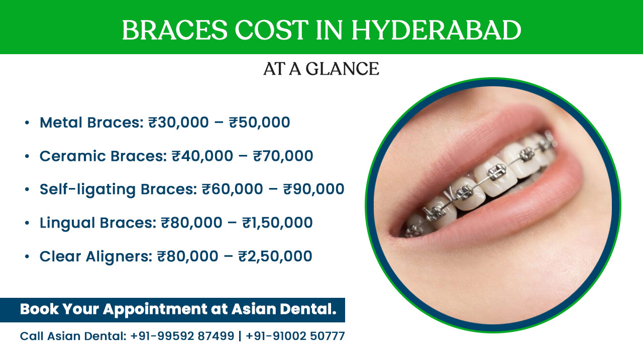 Dental Braces Cost in Hyderabad - Asian Dental