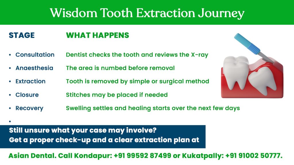 wisdom tooth extraction journey