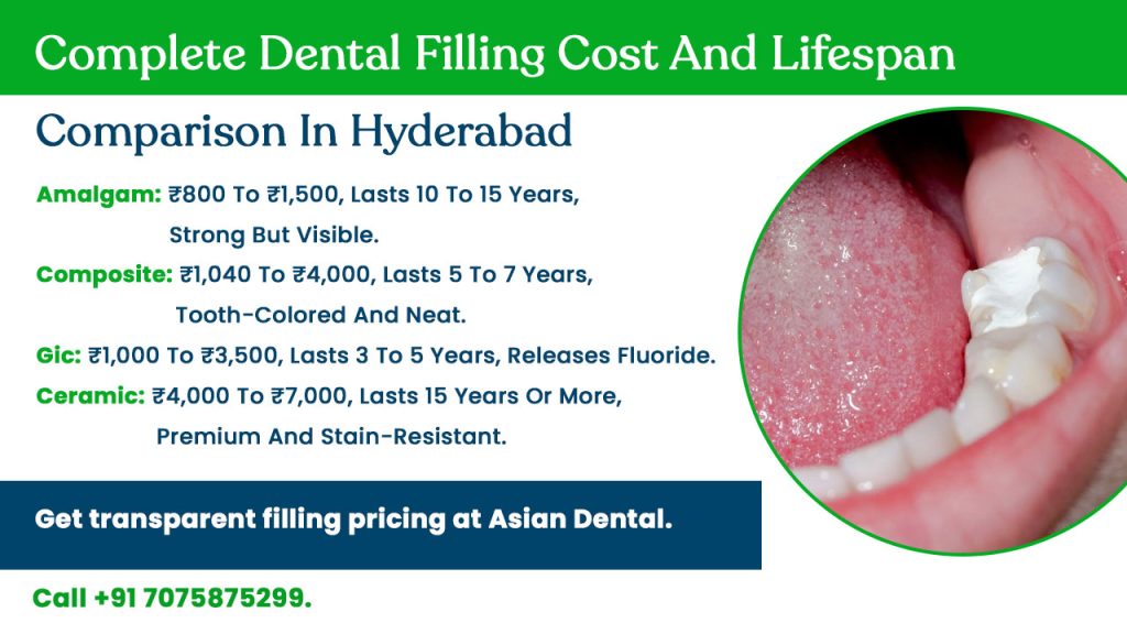 dental filling cost and lifespan