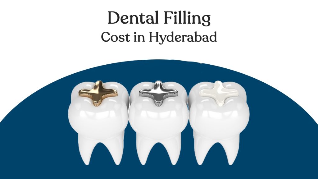dental filling cost in hyderabad
