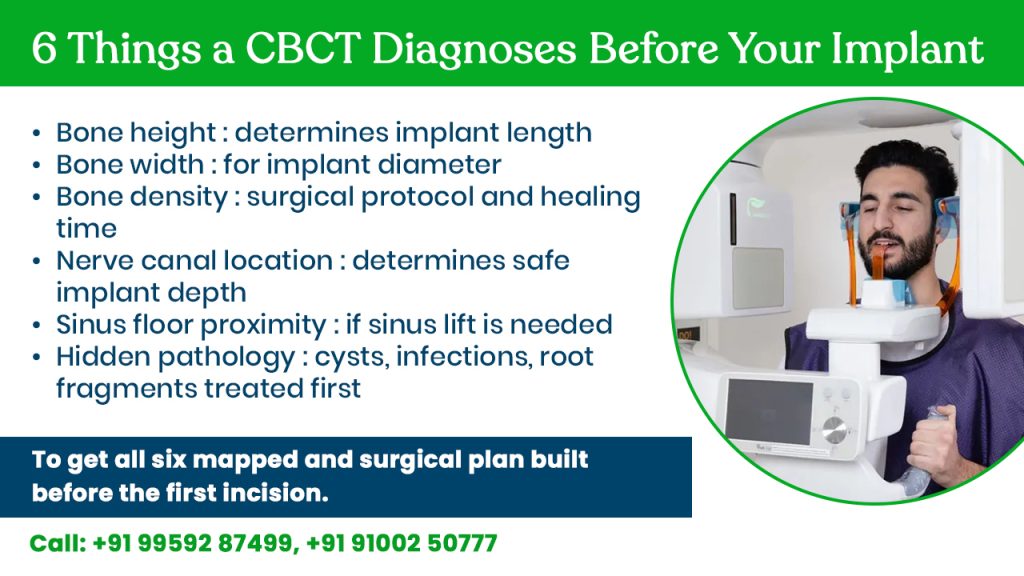 before your implant surgery