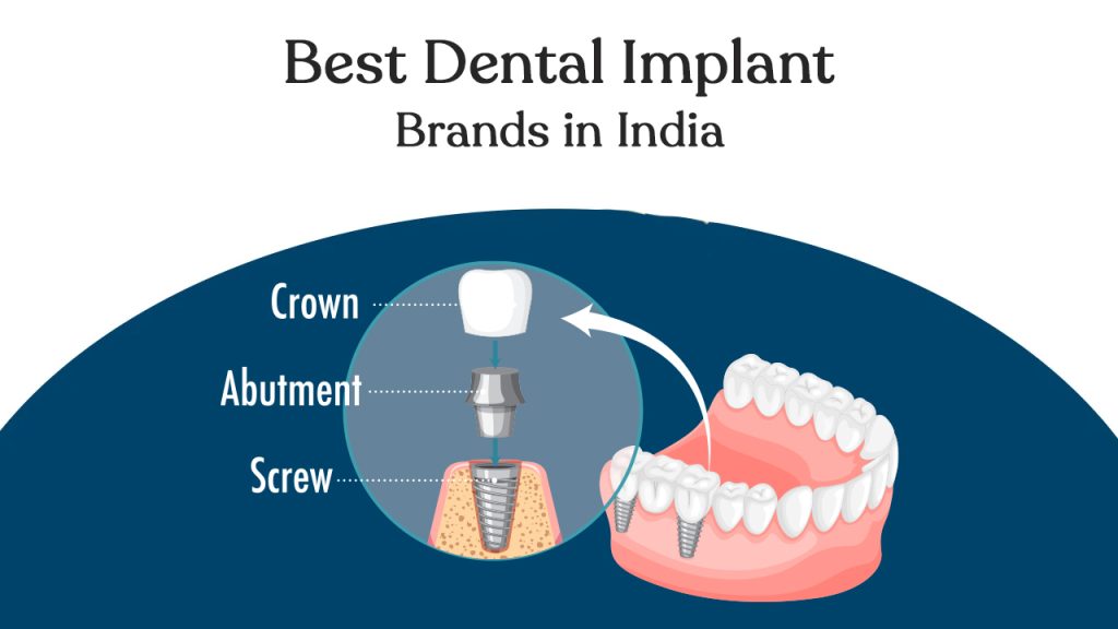 best dental implant brands in india