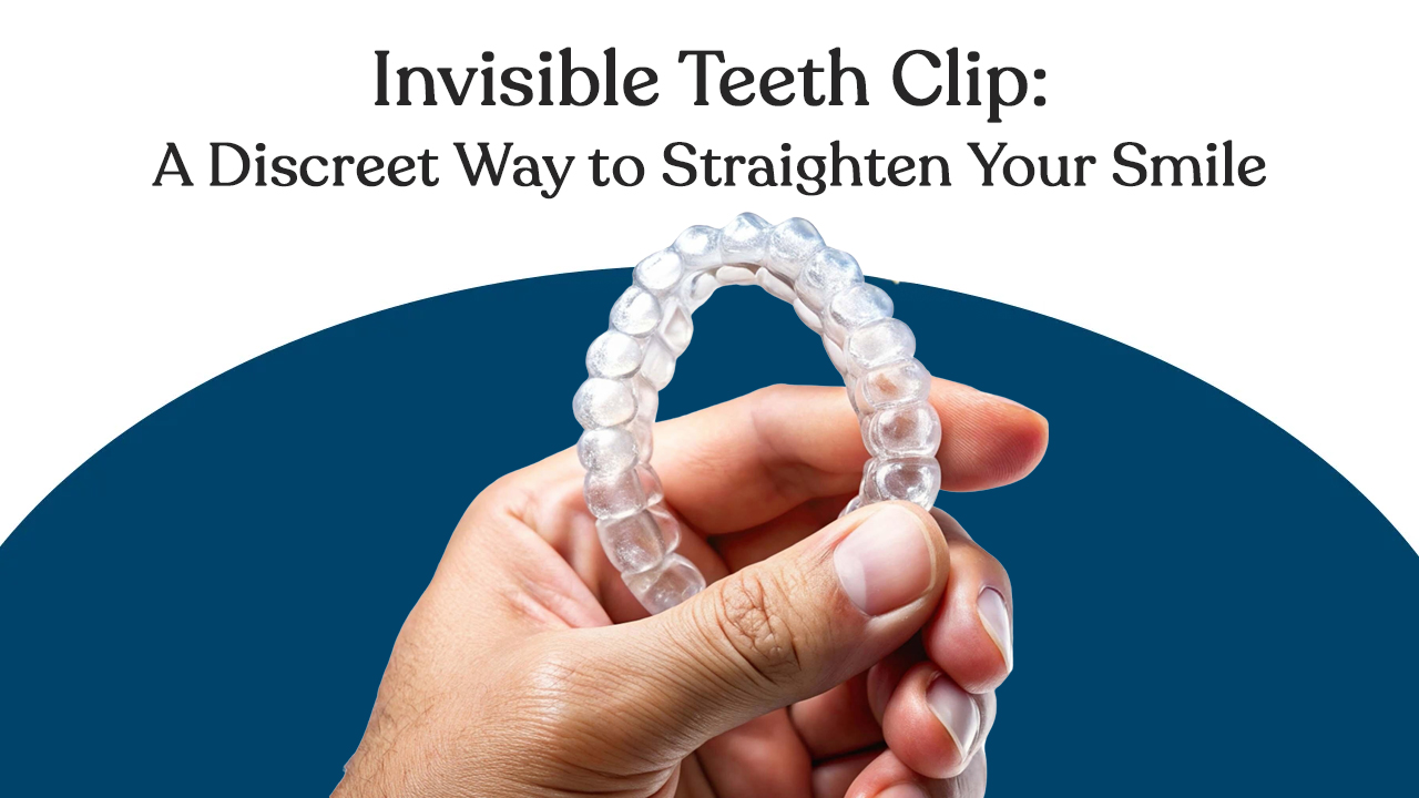 Invisible Teeth Clip: How Aligners Work, Benefits and Cost?