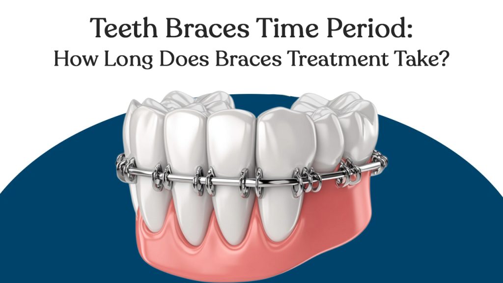 teeth braces time period