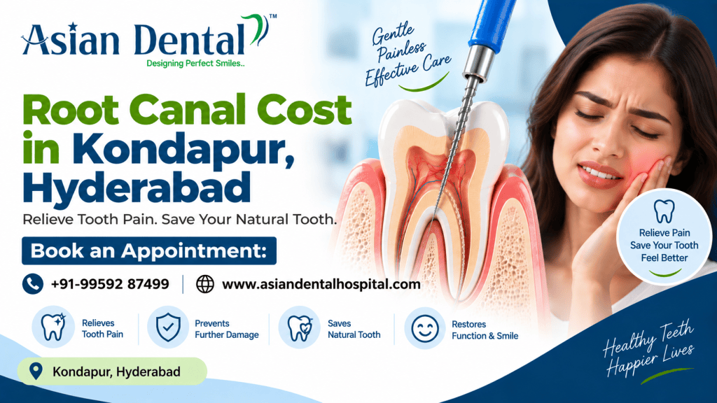 Root Canal Cost in Kondapur