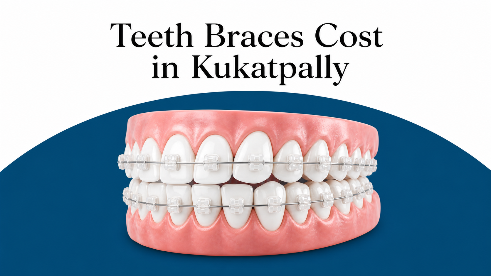 Teeth Braces Cost in Kukatpally