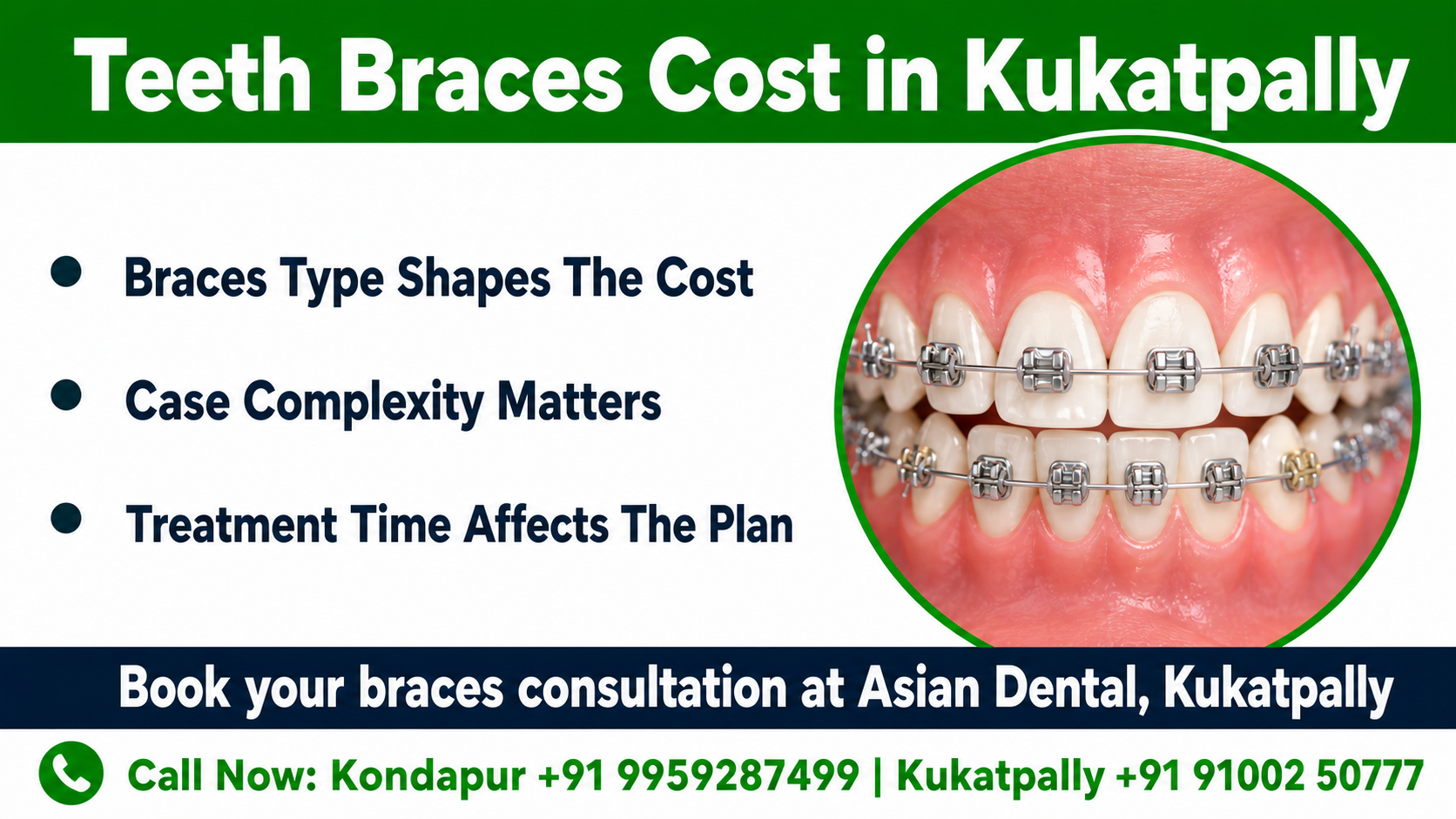 Infographic chart showing the main drivers of braces charges, including brace type, case severity, treatment duration, diagnostics, and retainers