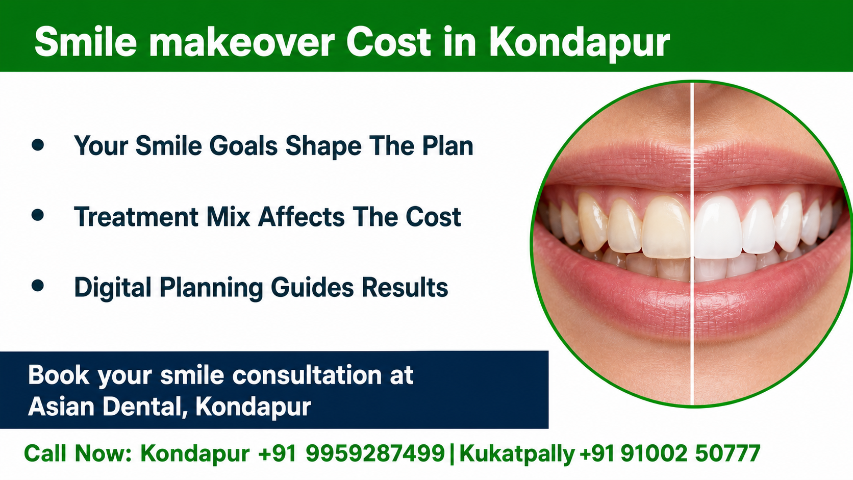 Infographic chart showing the main drivers of smile makeover pricing, including number of teeth, materials, gum health, alignment needs, and lab work