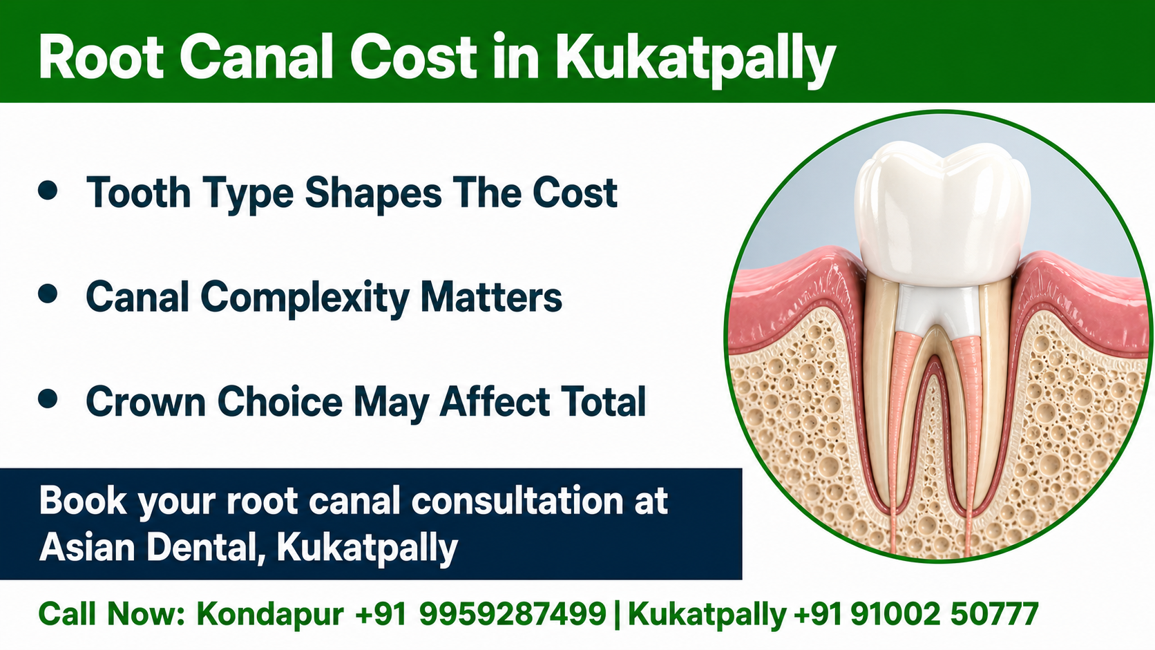 Infographic chart showing what a root canal price depends on, including tooth type, canal count, infection severity, and advanced microscope or laser technique