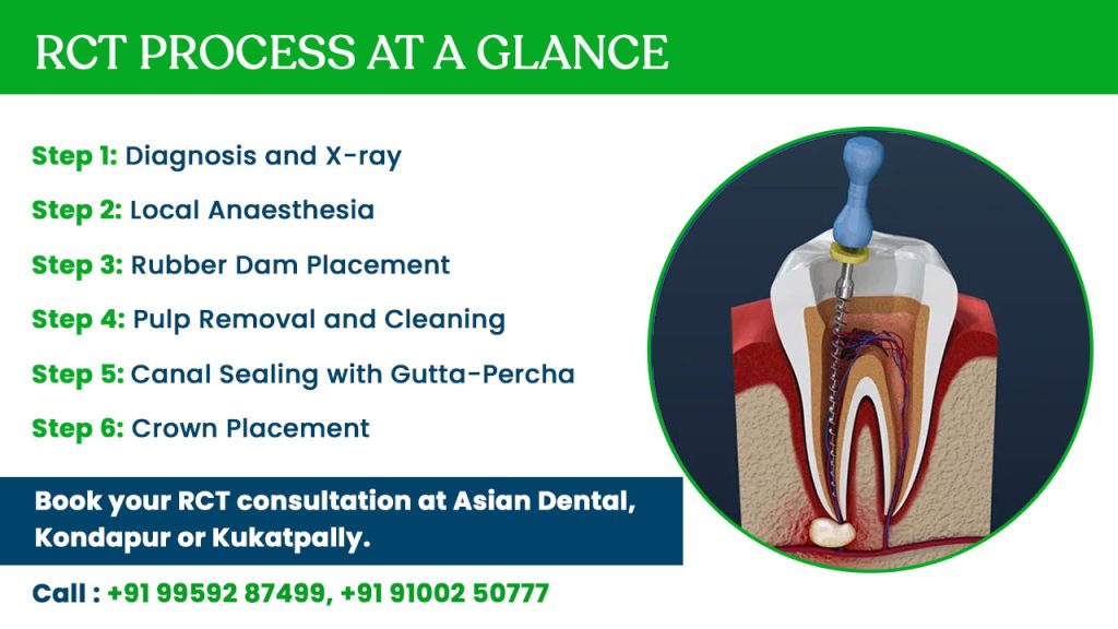 rct process