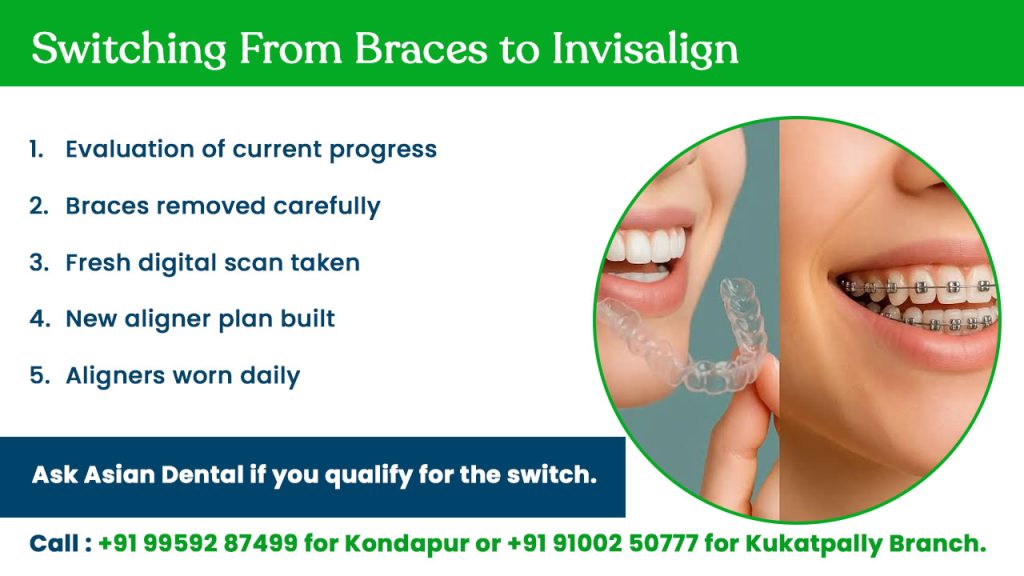 switching from braces to invisalign