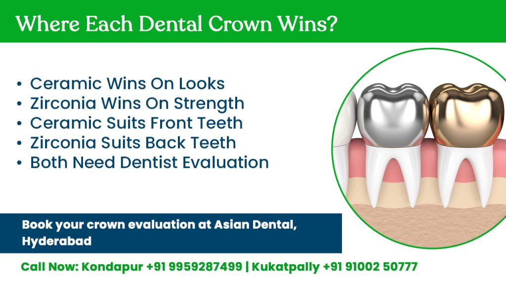where each dental crown wins
