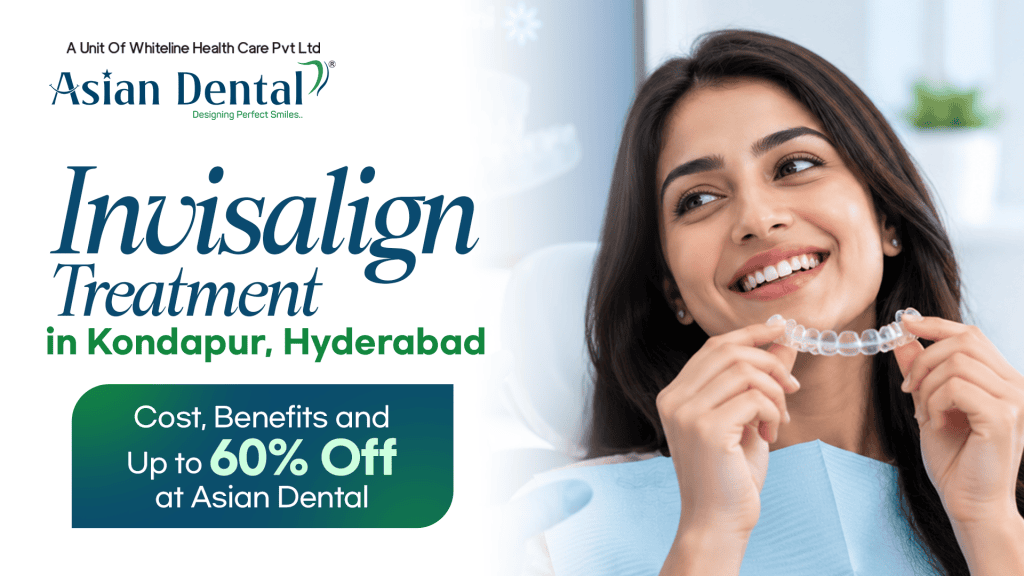 Invisalign Treatment in Kondapur