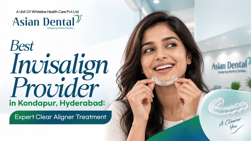 Invisalign treatment in Kondapur
