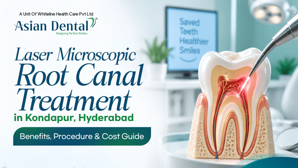 Laser Root Canal Treatment in Kondapur