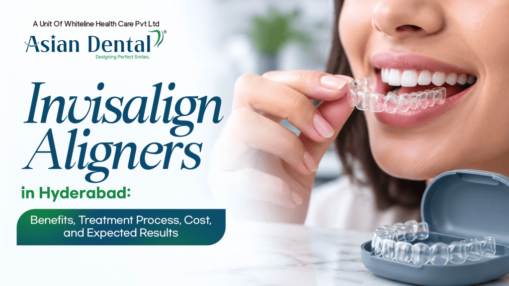 Invisalign aligners in Hyderabad
