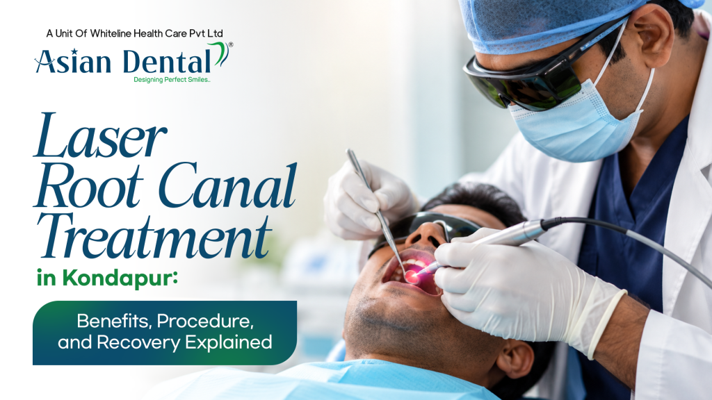 Laser Root Canal Treatment in Kondapur