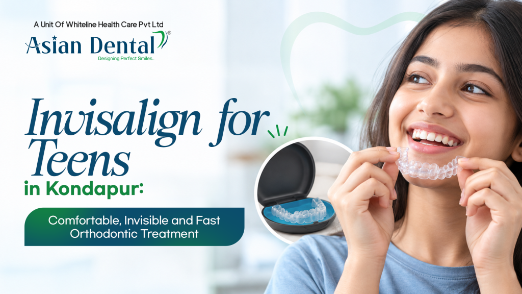 Invisalign for Teens in Kondapur
