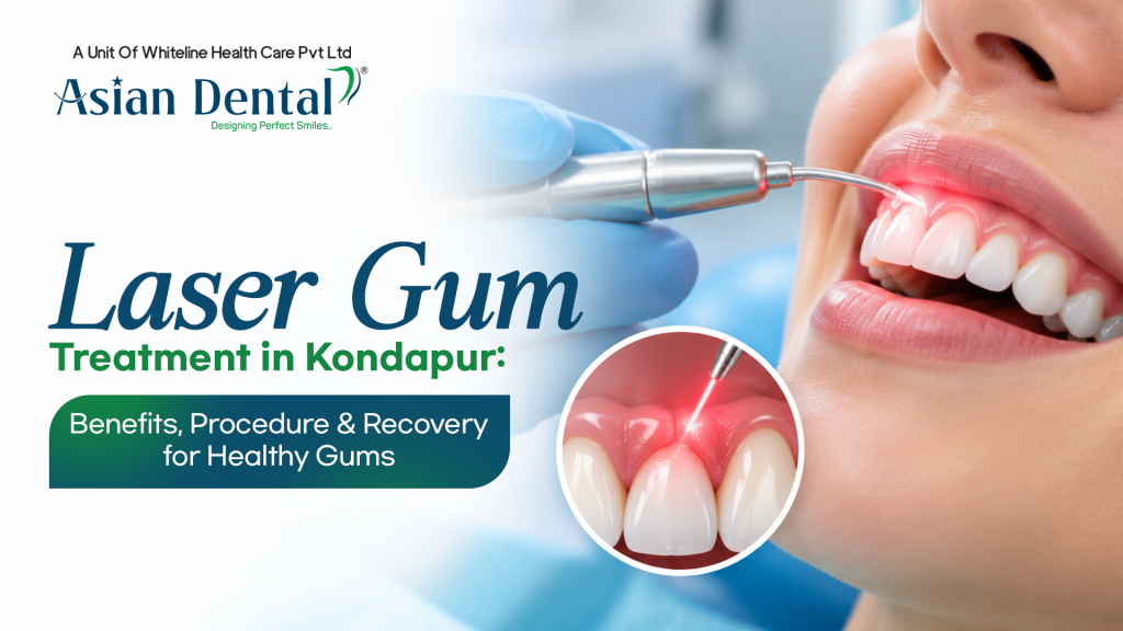 - Laser Gum Treatment in Kondapur
